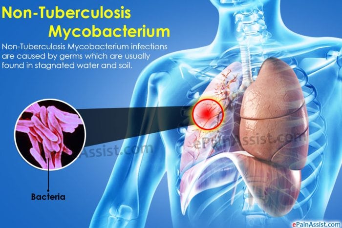 Source: ePainAssist