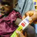 A doctor checks the mid-upper arm circumference of two-year-old Modu Baba, who is malnourished