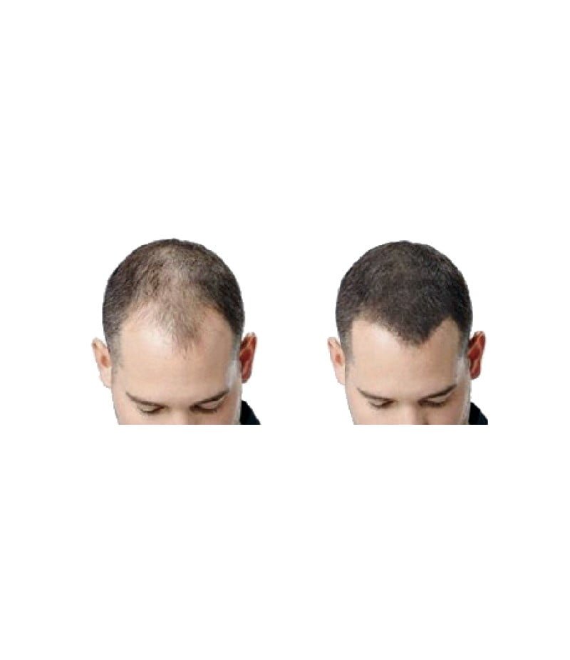 fibra-capilar-100-natural-bote-25-grs-accesorios-distribuciones ti