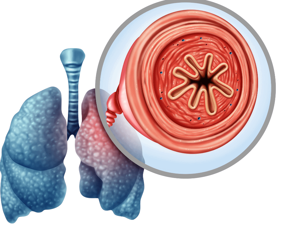 An image of lungs and a symptoms inside it