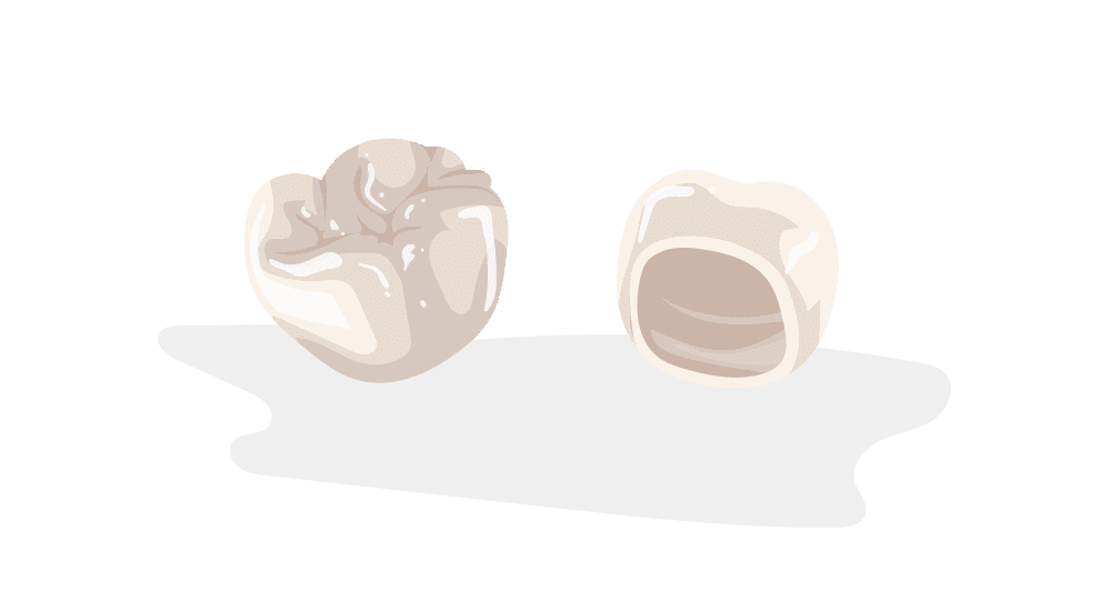 crowns-part-2 Don’t Let a Toothache Steal Christmas