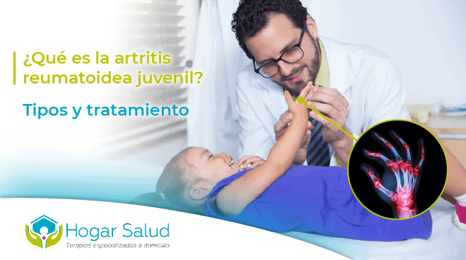¿Qué es la artritis reumatoidea juvenil?