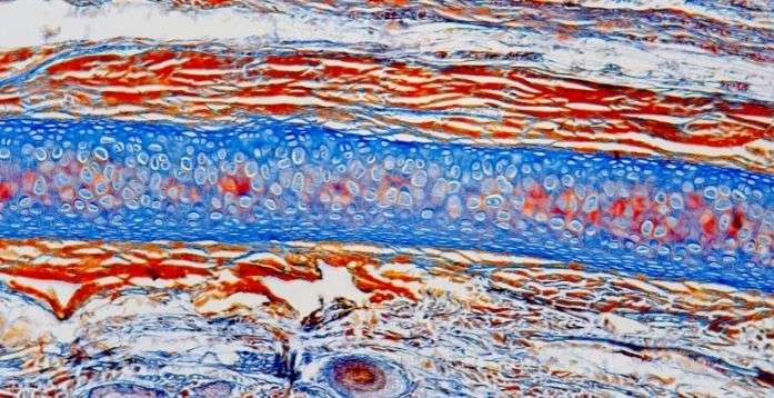 Connective tissues are incredibly strong structures throughout your body