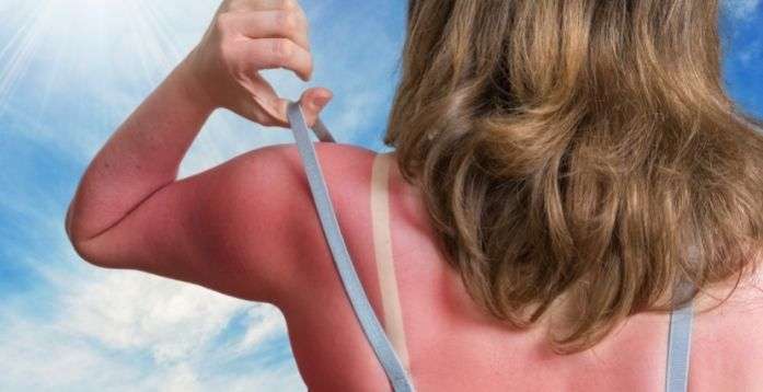 Excessive sun exposure can degrade collagen