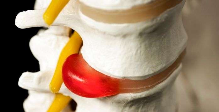 Athletes need their cartilage to be healthy in order to perform pain free