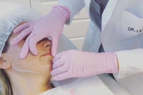Dr. Karin Lewinsky – Zertifizierte Expertin für Fadenlifting nach dem ÄsthOpG in Wien
