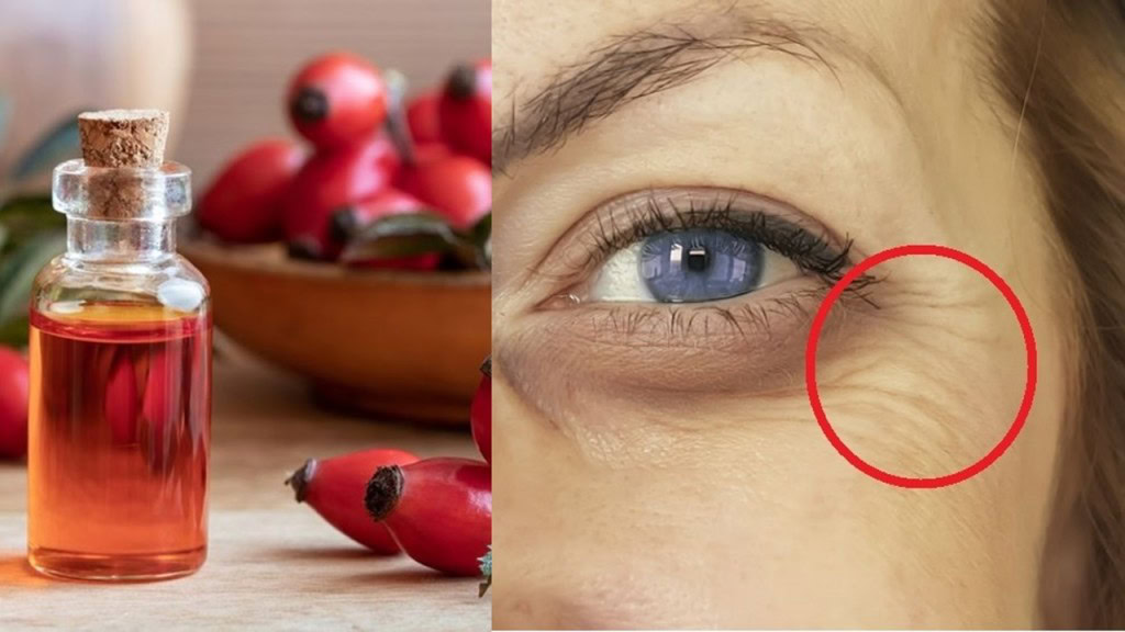 remover rugas e marcas de pele com óleo de rosa mosqueta