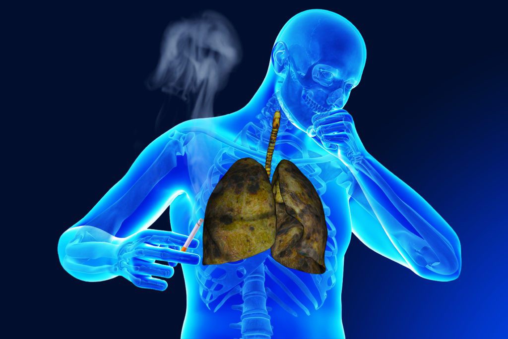 Doenças Respiratórias