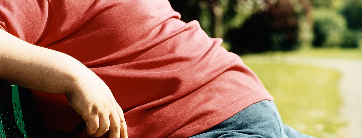 Man wondering how much gastric bypass surgery costs