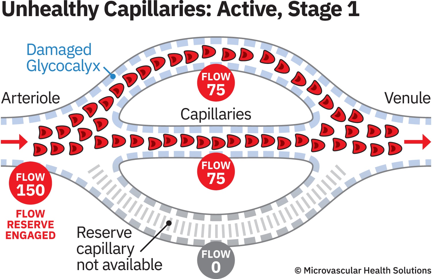 cap-unhealthy-active-stage1-MHS-1500