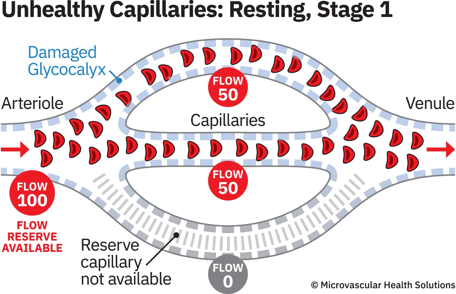 cap-unhealthy-resting-stage1-MHS-1500