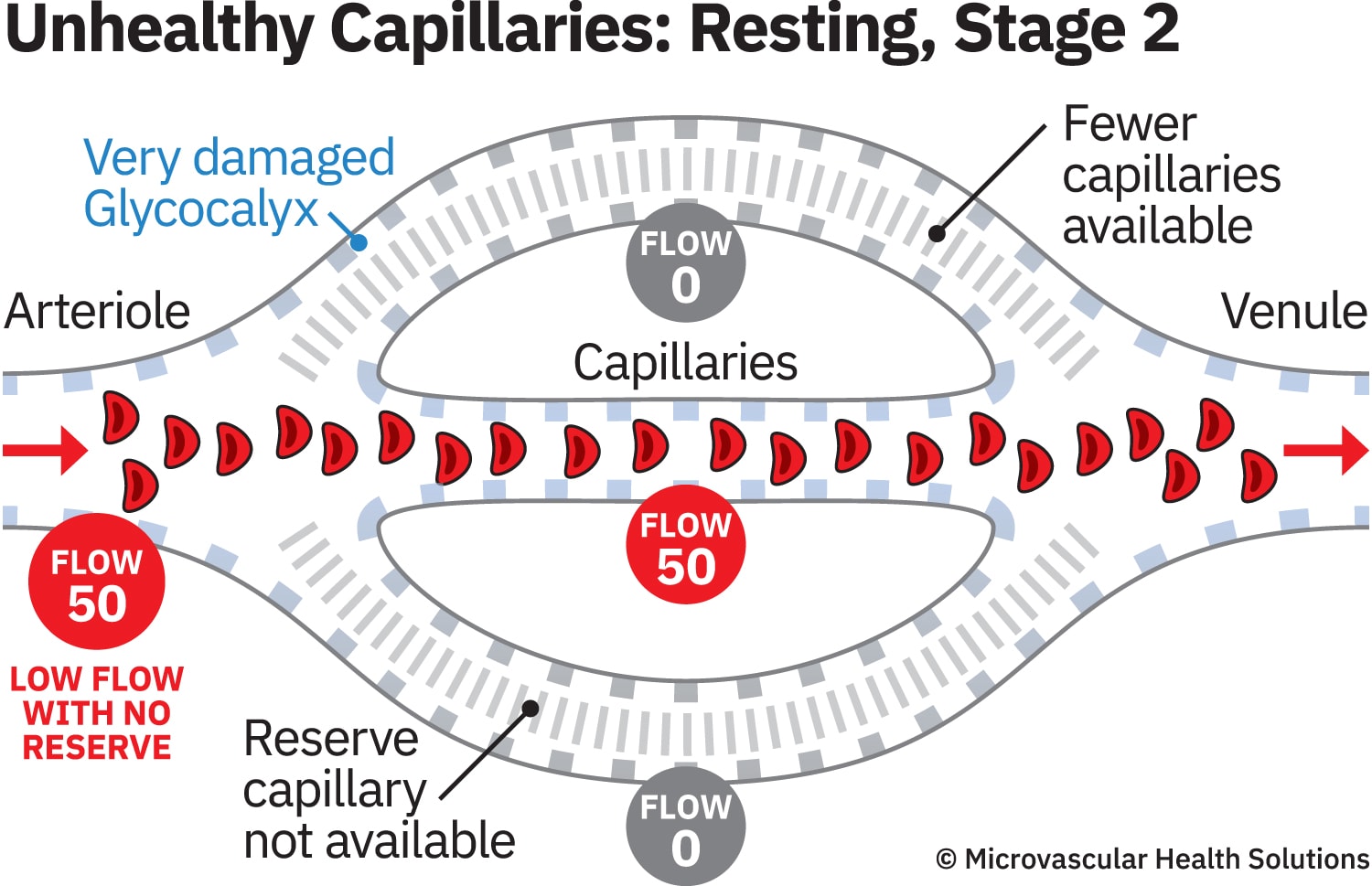 cap-unhealthy-resting-stage2-MHS-1500