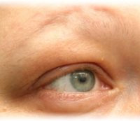 Haarlospatientin Permanent Make Up vorher