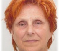 Vorher unpigmentiert Permanent Art