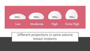 Breast Implant Size Chart