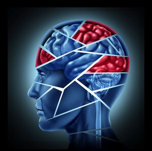 Fractured side view of the human head and brain