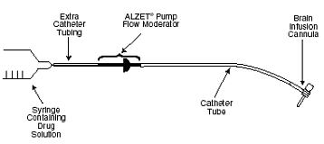 Schematic showing how to fill a brain infusion kit with a syringe containing drug solution