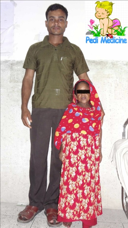 Dwarf Lady With Her husband