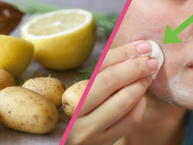 batata e limão para remover manchas do rosto batata e limão para remover manchas do rosto