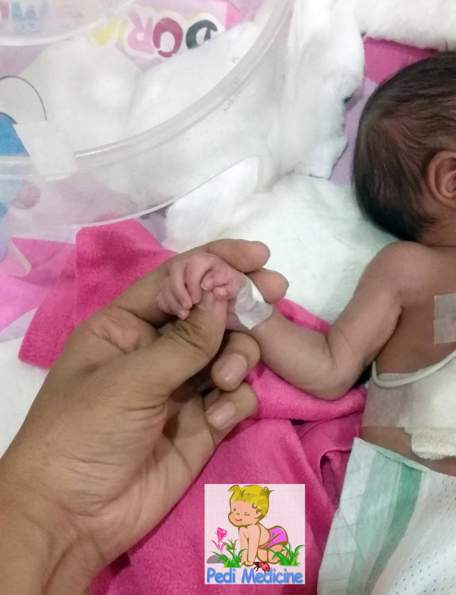 congenital birth defect polydactyle