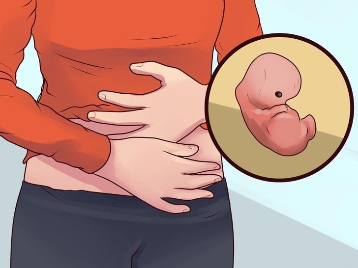Aborto Espontâneo - Causas, Sintomas e Tratamentos 1