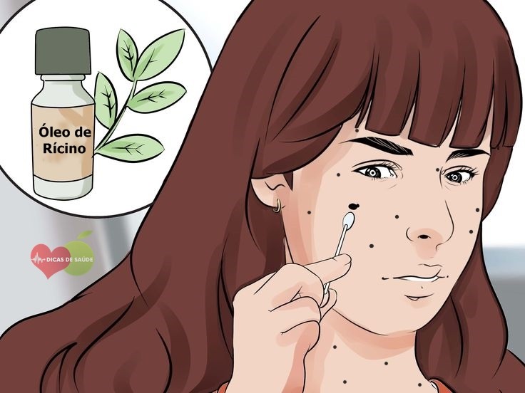 como tirar manchas escuras da pele