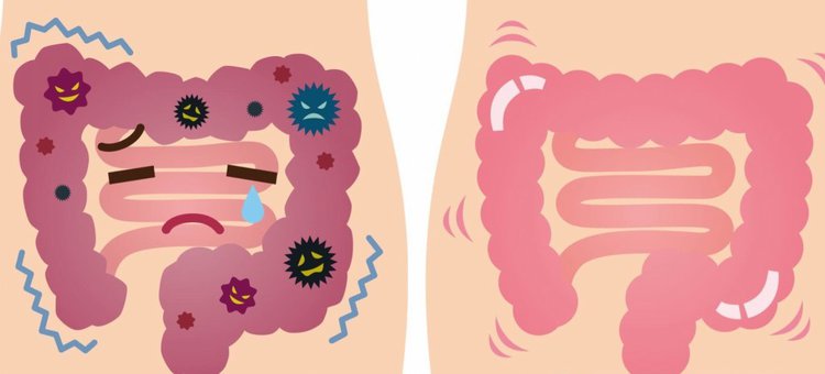Maneiras Ideais de Eliminar o Glúten do Corpo Maneiras Ideais de Eliminar o Glúten do Corpo