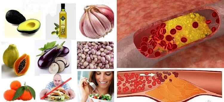 Dicas Para Reduzir o Níveis de Triglicerídeos Elevado Dicas Para Reduzir o Níveis de Triglicerídeos Elevado