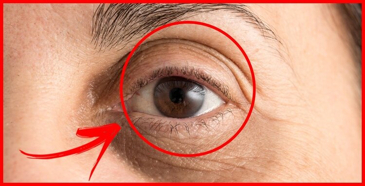 vitamina E e oleo de coco para eliminar rugas vitamina E e oleo de coco para eliminar rugas