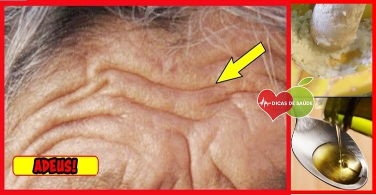 botox caseiro botox caseiro