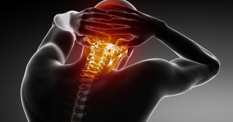 Vertebrobasilar Vertebrobasilar