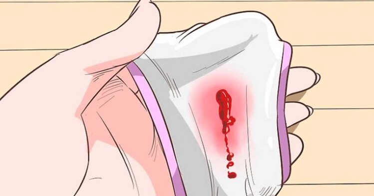 cervicite cervicite