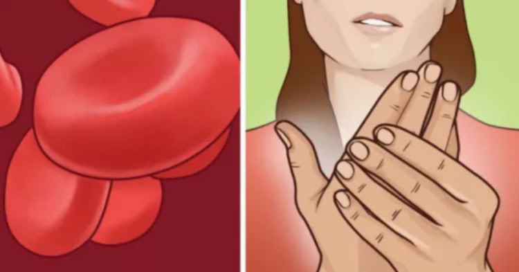 remédios caseiros para tratar a anemia