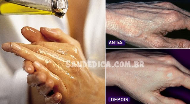 cremes caseiros para rejuvenescer as maos e eliminar rugas cremes caseiros para rejuvenescer as maos e eliminar rugas
