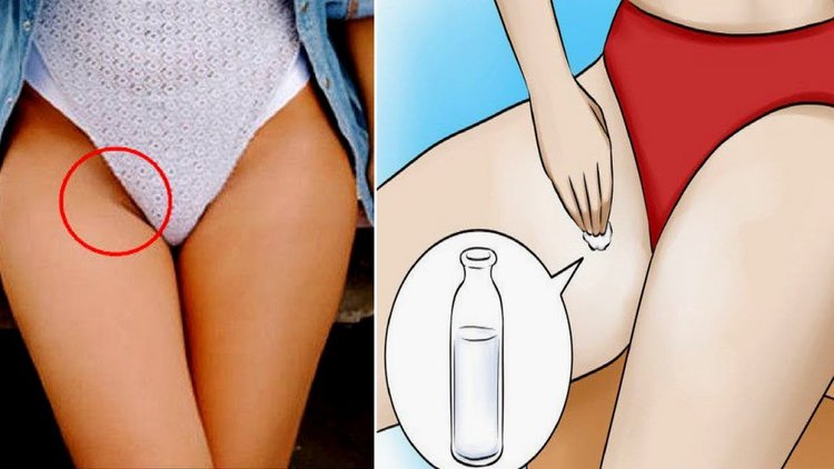 Irritações nas Coxas Durante o Verão Irritações nas Coxas Durante o Verão