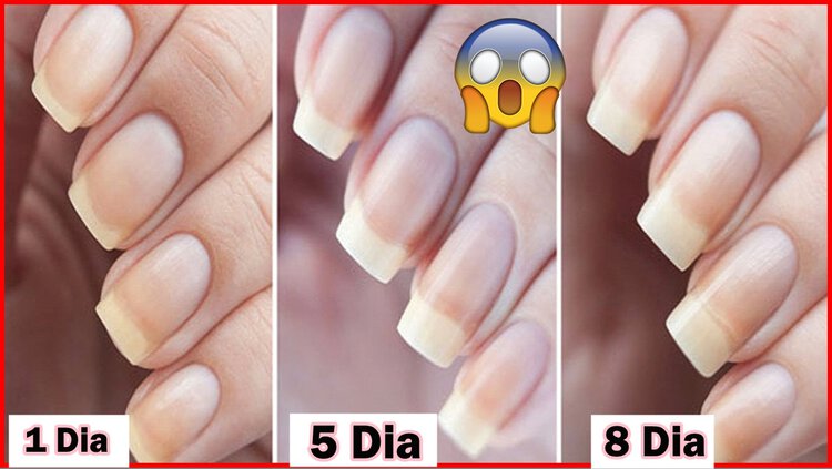 receita caseira para acelerar o crescimento das unhas em 8 dias receita caseira para acelerar o crescimento das unhas em 8 dias