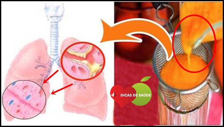 Como Eliminar Catarro dos Pulmões em Apenas 1 Noite | Dicas de Saúde