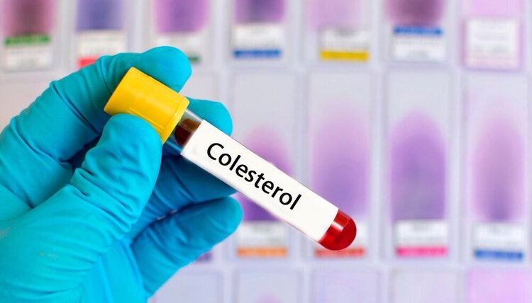 medicamentos naturais que ajudam no tratamento de colesterol alto medicamentos naturais que ajudam no tratamento de colesterol alto