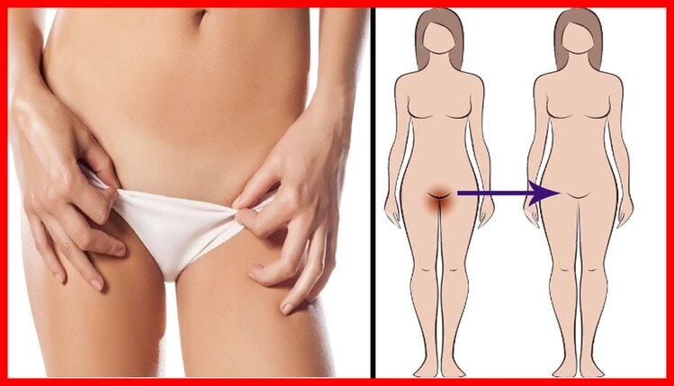 dicas faceis para eliminar odor vaginal dicas faceis para eliminar odor vaginal