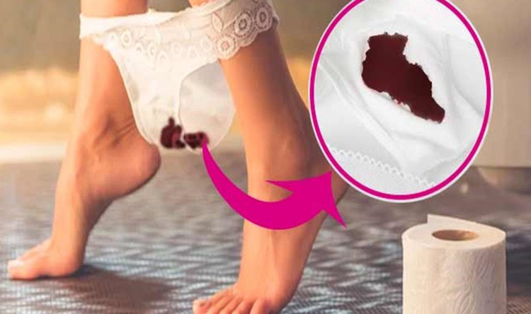 menstruaçao escura menstruaçao escura