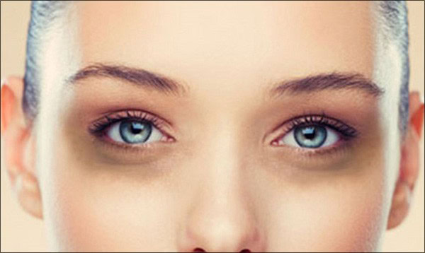Dicas Para Remover as Olheiras Dicas Para Remover as Olheiras