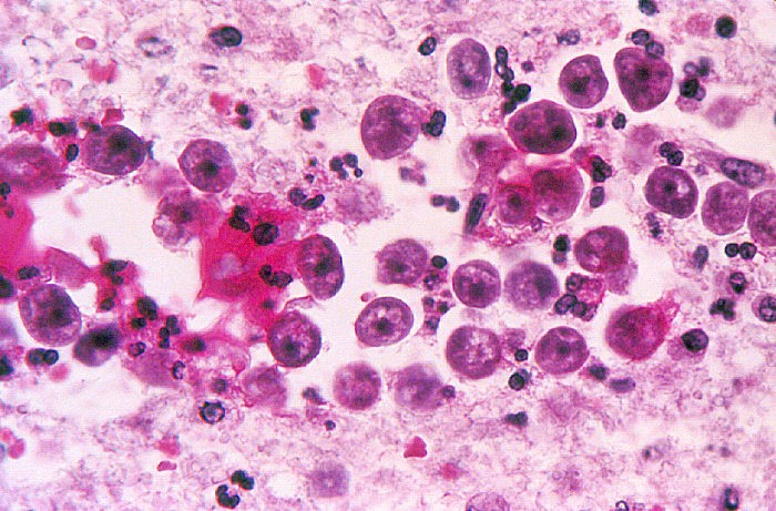 Naegleria Naegleria