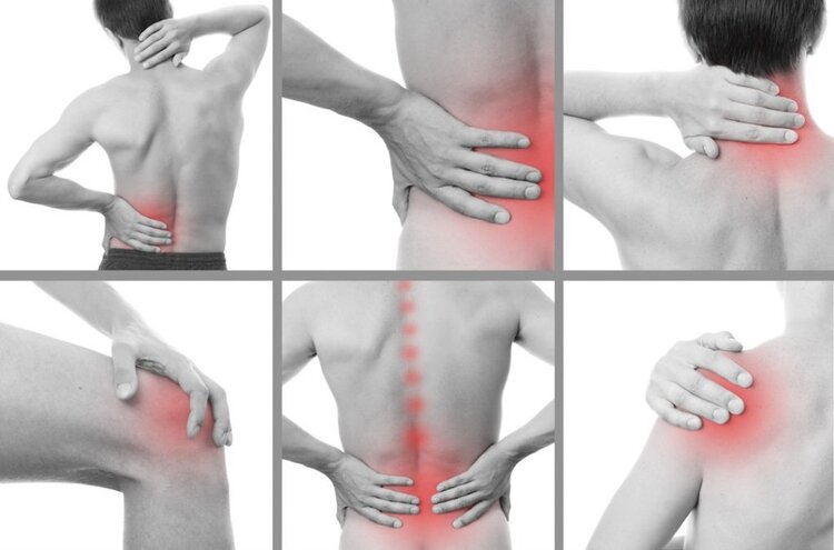 Dores Musculares Dores Musculares