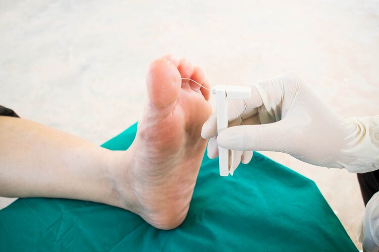 Neuropatia Sensorial - Causas Neuropatia Sensorial - Causas