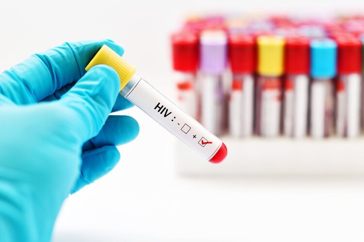 HIV / SIDA HIV / SIDA
