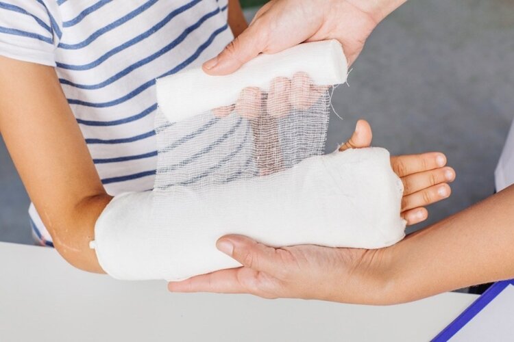 ter quebrado os ossos prejudica osteoporose ter quebrado os ossos prejudica osteoporose