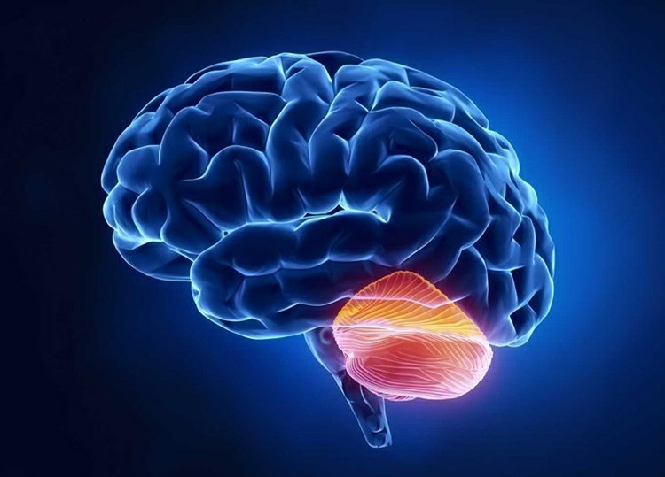 ataxia ataxia