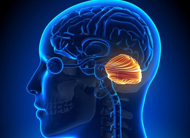 ataxia cerebelar ataxia cerebelar