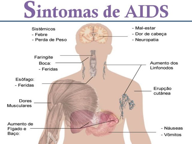 Sintomas da AIDS Sintomas da AIDS