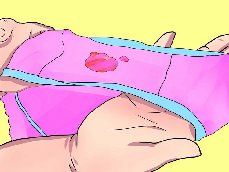 Corrimento Vaginal Corrimento Vaginal